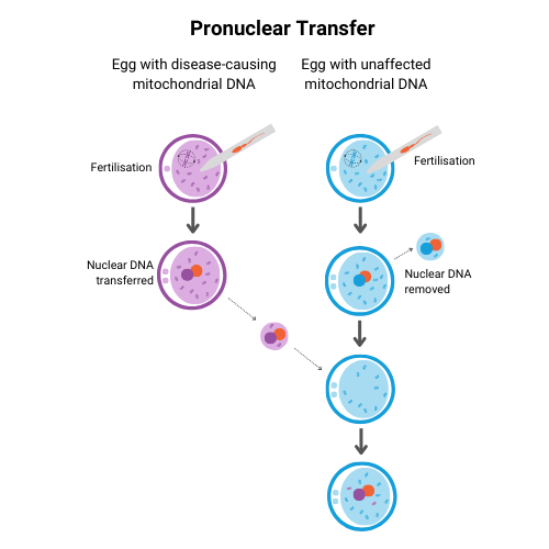 A graphic showing a pronuclear transfer